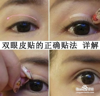 怎样才能有双眼皮