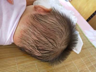 胎宝宝什么时候长头发