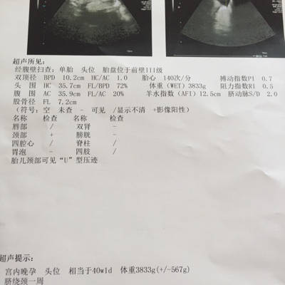 怀孕38周胎儿双顶径多少正常