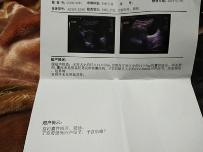 怀孕7周有胎心胎芽吗