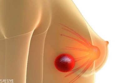 乳腺结节怎么治疗方法