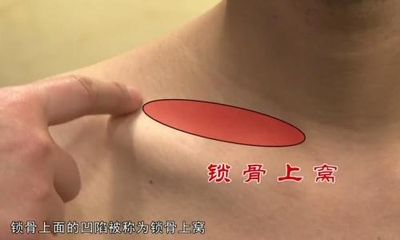 锁骨部位疼是怎么回事