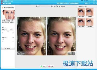 眉毛旁边的痘痘怎么消除