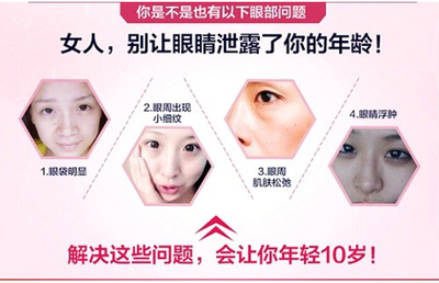 什么眼霜可以去眼袋