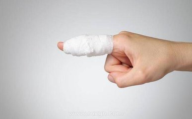 梦见自己手指断了一截