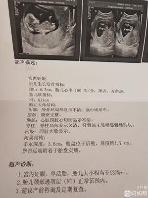 怀孕多少周可以做nt