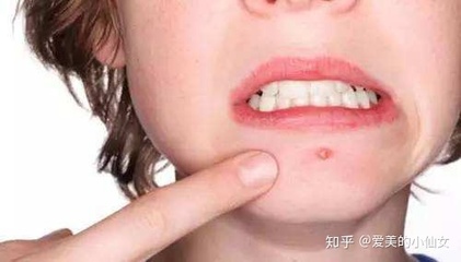 指甲疤痕如何去除