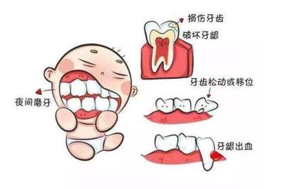 孩子磨牙是怎么回事