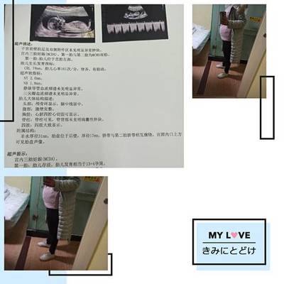 孕29周是几个月