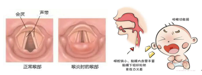 喉咙充血是怎么回事
