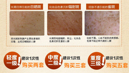 去斑美白要多少钱