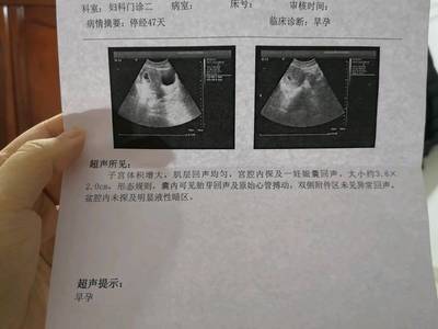 停经8天能测出怀孕吗