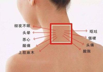 胳膊一直麻是怎么回事