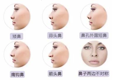 玻尿酸适合什么皮肤