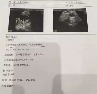 怀孕8周胎儿图片欣赏