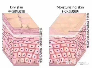 男生经常长痘痘要去角质吗