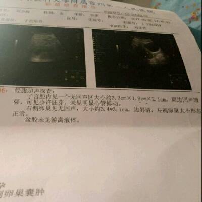 怀孕60天胚芽多大正常