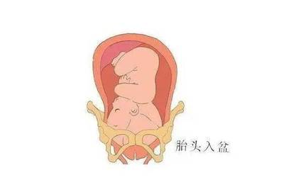 胎儿入盆的症状