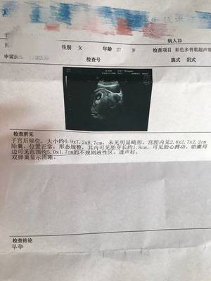 怀孕8周胎芽多大正常