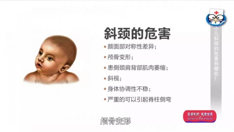 新生儿 斜颈
