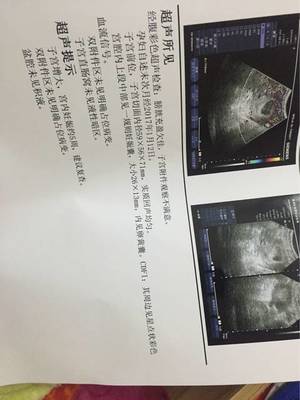 宝宝几周有胎心