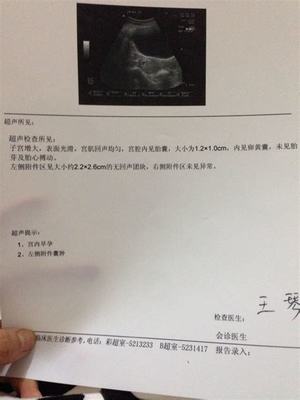 怀孕7个月胎儿有多大