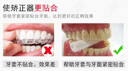 前面门牙疼是怎么回事