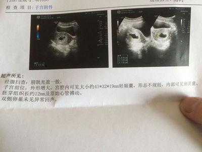 一般几天会怀孕