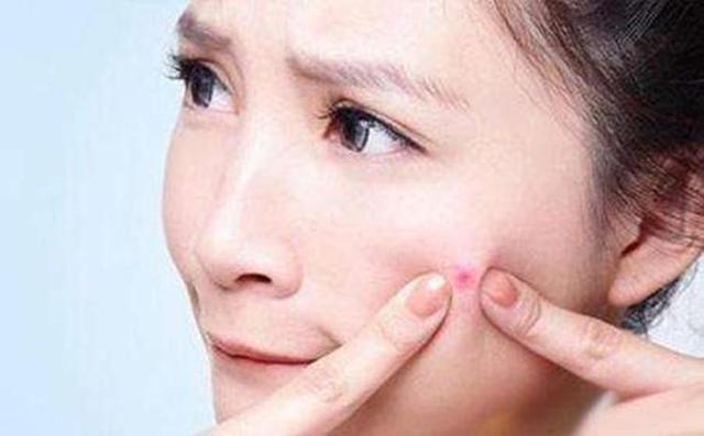 28了还长痘痘