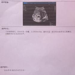 怀孕五周肚子疼是怎么回事