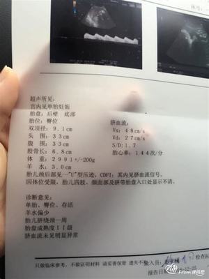 孕妇32周做什么检查