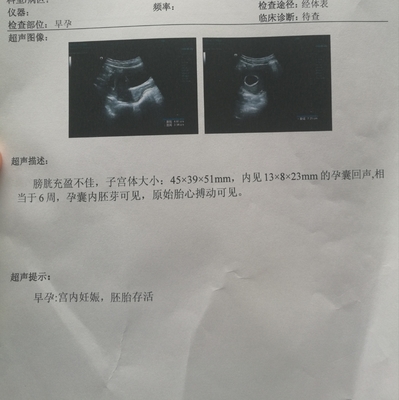 孕酮吃多了对胎儿有影响吗