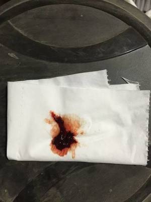 梦见自己来例假了见血
