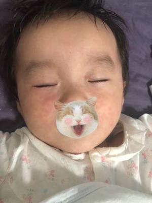 宝宝高烧一般持续几天