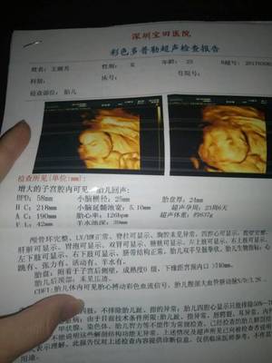 四个月可以做四维彩超吗
