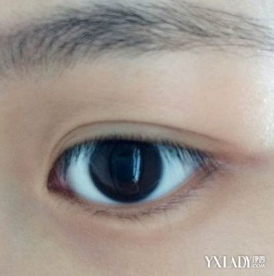 小眼角充血是怎么回事