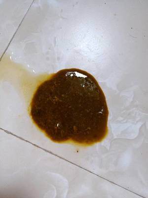 宝宝粑粑里有黑色颗粒