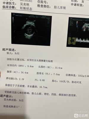 怀孕38周胎儿双顶径多少正常