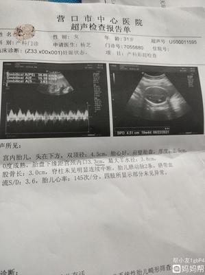 二十周的胎儿有多大
