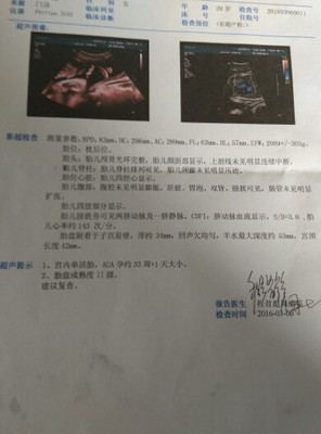 33周宝宝4斤正常吗