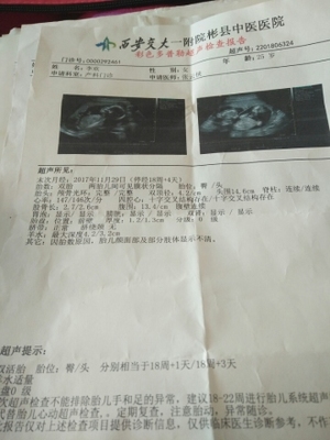 怀孕18周胎儿稳定了吗