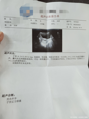 怀孕单