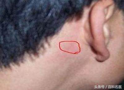 右耳朵后面疼是怎么回事