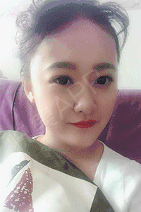 玻尿酸后期肿胀怎么办