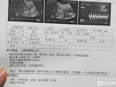 四个半月的胎儿有多大