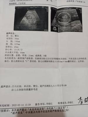 18周胎儿真实图