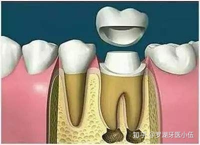 牙科费用是多少