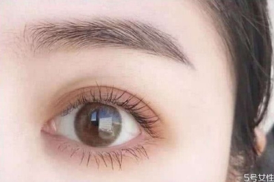 眼睛凹陷可以做双眼皮吗