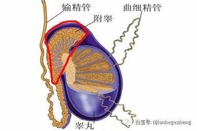 附睾囊肿怎么治疗