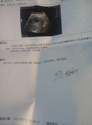 刚发现怀孕能药流吗